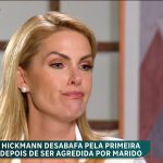 Ana Hickmann